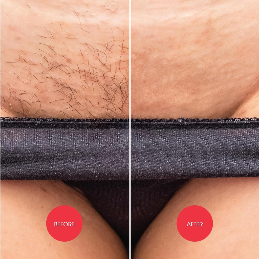 Nad's Down Under Cream for Women, Intimate Hair Removal Cream 150 ml